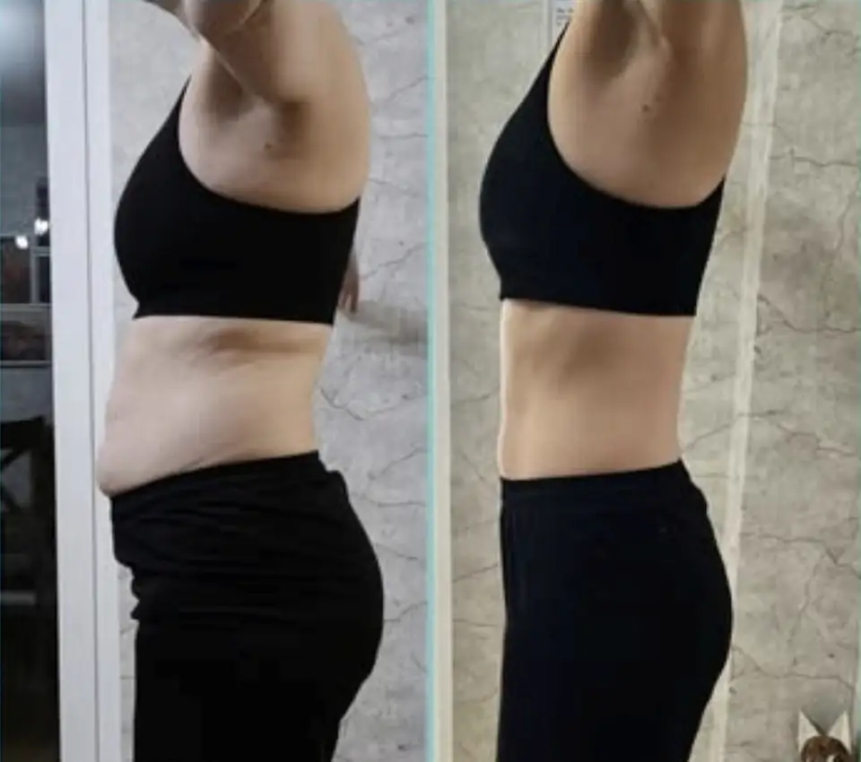 Before and after of a client: both sides show a side view in a black sports top and black shorts with an arm raised, in front of a marble-effect wall.