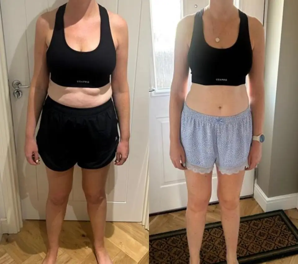 Before and after of a client: front view standing in a hallway, left in a black sports top and black shorts, right in a black sports top and blue patterned shorts with a necklace and watch.